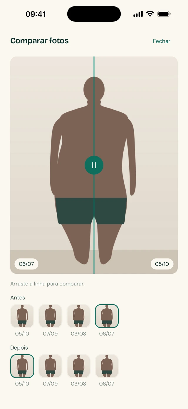 Tela de fotos de progresso do TirzeFlow, com o divisor entre antes e depois